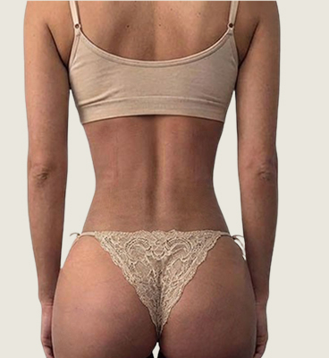 After – Front